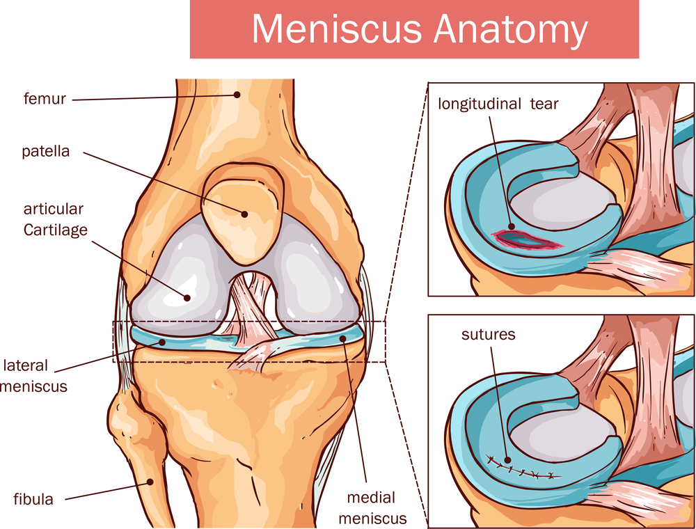 Injuries-in-the-Meniscus